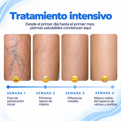 Crema para Piernas Varicosyl Alifeet ®